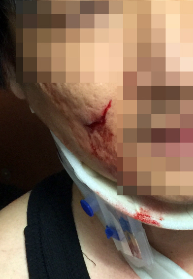 무고한 시민 착각해 체포한 경찰 탓에 얼굴 찢어진 20대 | 인스티즈