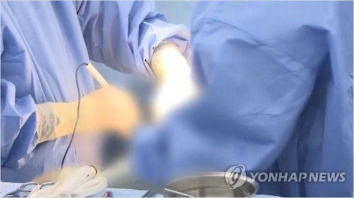 성기확대 3회 수술로 조직 괴사배상은 달랑 800만원 노컷뉴스 