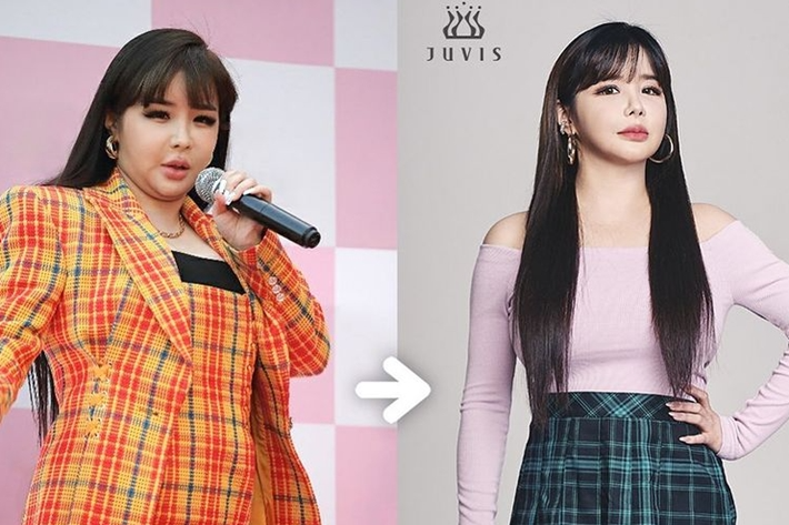 Park Bom, 11kg weight loss, reveals “I’m getting healthier”