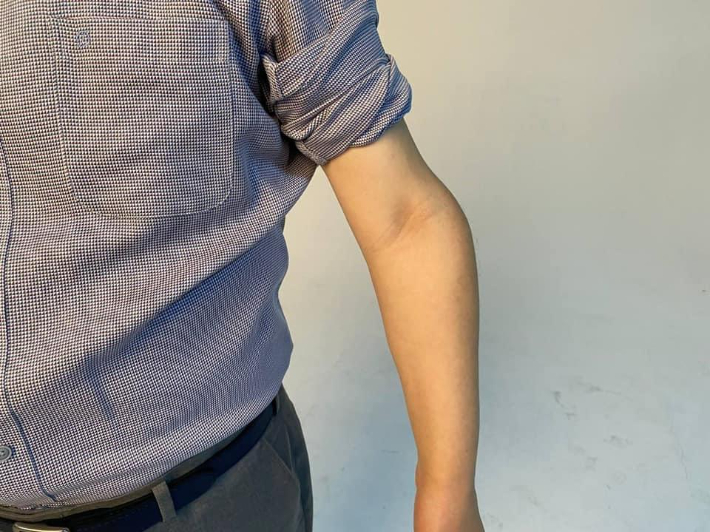 더불어민주당 대권주자인 이재명 후보는 지난 17일 소년공 시절 부상으로 비틀어진 자신의 팔 사진을 공개했다. 이재명 지사 페이스북 캡처

(끝)

 연합뉴스
