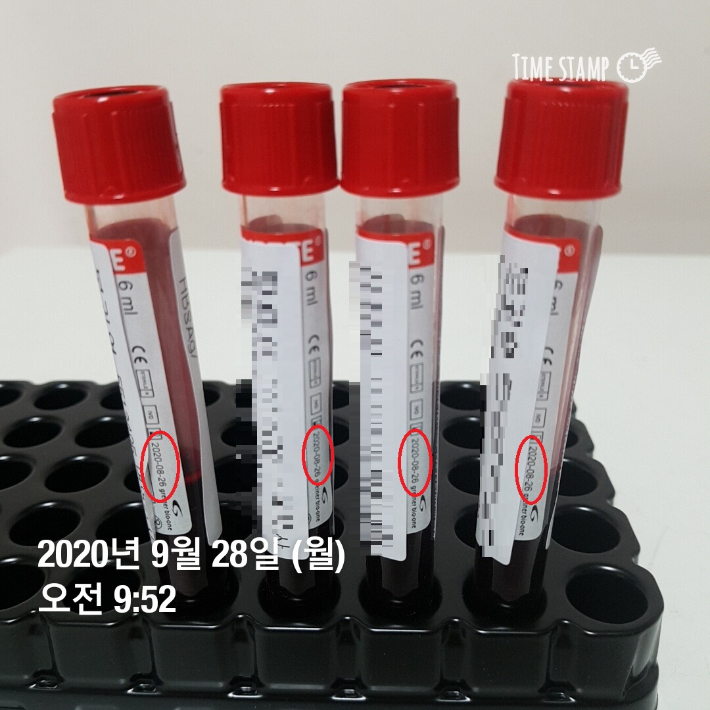 지난해 9월 인천의료원에서 사용기한이 지난 진공채혈관이 발견됐다. 기한이 지난 채혈관에는 이미 환자들의 혈액이 담겨 있었다. 독자제공