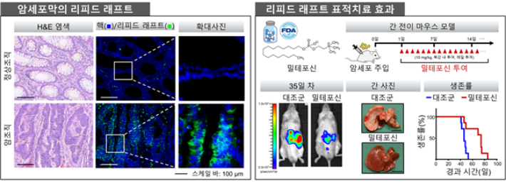 리피드 래프트 표적치료를 통한 항암치료 전략(왼쪽), 암세포막의 리피드 래프트: 정상조직과 암조직에서 관찰한 결과 정상세포와 비교하여 암세포에 리피드 래프트가 많은 것을 확인하였다(오른쪽). 리피드 래프트 표적치료 효과: 마우스 모델에 암세포를 주입하여 밀테포신을 투여한 결과, 밀테포신에 의해 간 전이가 감소하고 마우스의 생존기간이 증가한 것을 확인하였다. 지스트 연구팀 제공