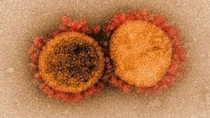 코로나19 바이러스 전자현미경 이미지. 미국 국립 알레르기 감염병 연구소(NIAID) 제공