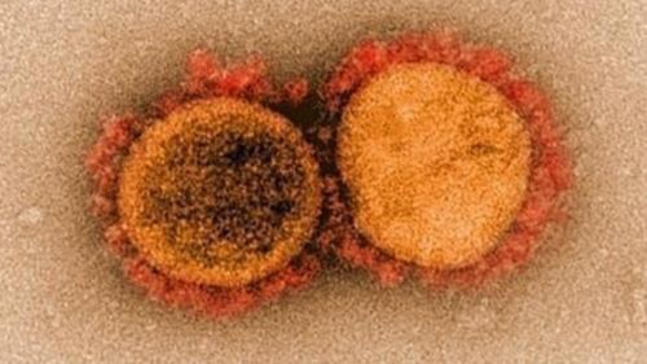코로나19 바이러스 전자현미경 이미지. 미국 국립 알레르기 감염병 연구소(NIAID) 제공