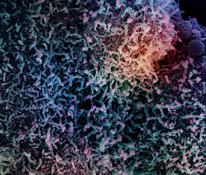 2021년 12월 18일 미국 국립보건원(NIH)이 공개한 신종 코로나바이러스 감염증(코로나19)을 일으키는 바이러스(SARS-CoV-2)에 감염된 세포의 전자현미경 사진. 연합뉴스