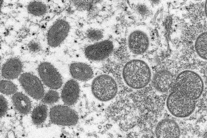원숭이두창 바이러스 이미지. 미 질병통제예방센터(CDC) 제공