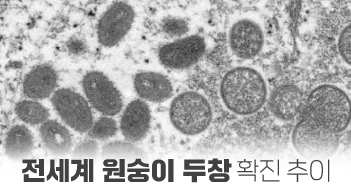 원숭이 두창 누적 확진자 1만 5510명…스페인 가장 많아[그래픽뉴스]