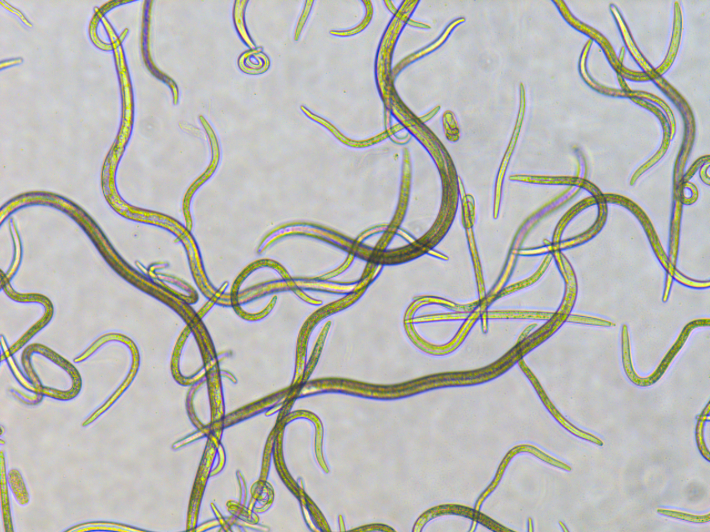 소나무재선충 현미경 사진. 산림청