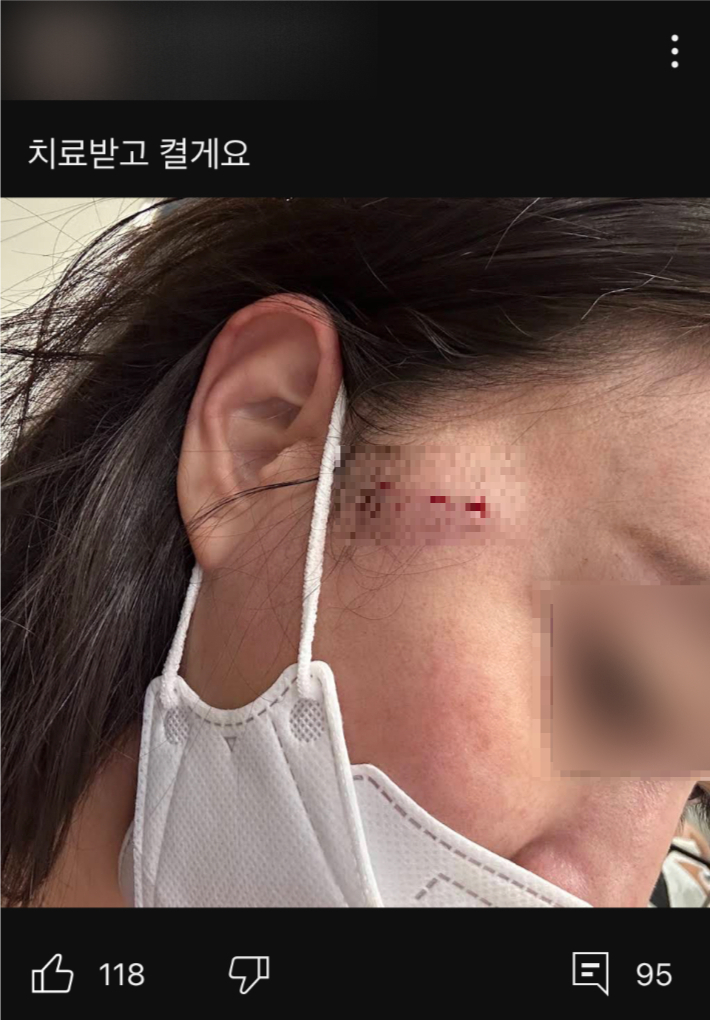 폭행 당한 30대 여성 B씨가 이후 올린 게시글. 유튜브 캡처