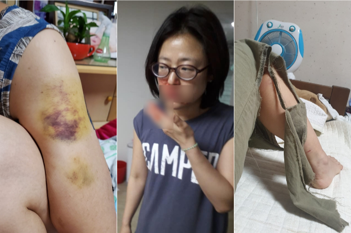 국민의힘 황보승희 의원은 15일 자신의 페이스북에 전 남편의 가정폭력을 주장하며, 피 흘리는 자신의 모습, 팔의 상처, 찢어진 옷 등 관련 사진을 게시했다 . 황보승희 의원 페이스북 캡처