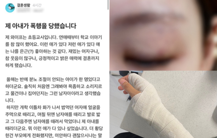 직장인 익명 커뮤니티에 올라온 심경 글과 폭행으로 인한 교사의 피해 모습. 익명 커뮤니티 캡처·서울교사노조 제공 