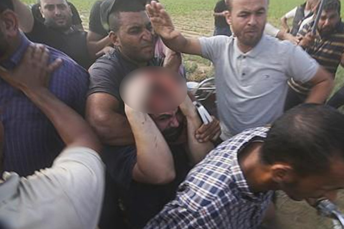 피투성이로 끌려가는 이스라엘 민간인. 연합뉴스