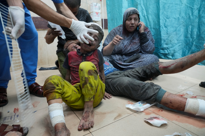 이스라엘군의 공습으로 다쳐 병원에 실려 온 가자지구 주민. 연합뉴스