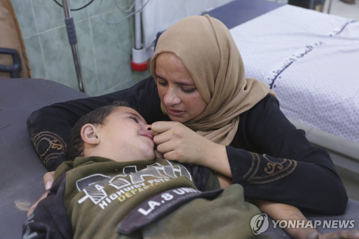 (라파 AP=연합뉴스) 30일(현지시간) 이스라엘의 가자지구 공습으로 다친 팔레스타인 소녀가 라파의 한 병원에서 치료를 기다리고 있다. 유엔 인도주의업무조정국(OCHA) 현황 보고서에 따르면 전날 기준 연료 부족 등으로 가자지구 병원 35개 중 12개가 운영을 중단했다. 2023.10.31 besthope@yna.co.kr 연합뉴스