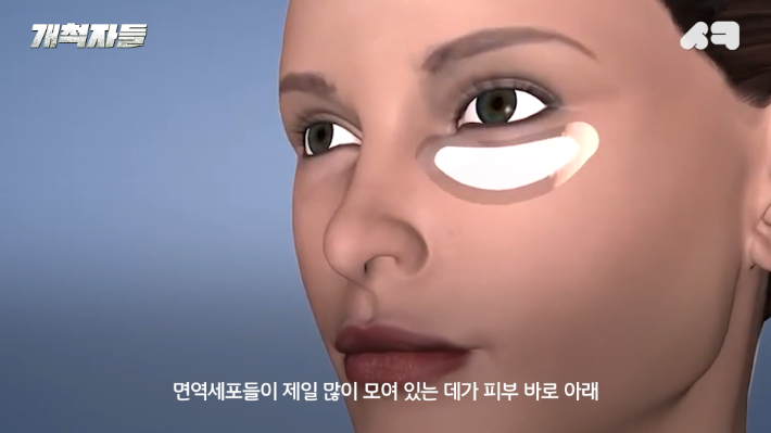 피부 국소 부위에 작용하는 마이크로 니들 패치. 개척자들 유튜브 캡처