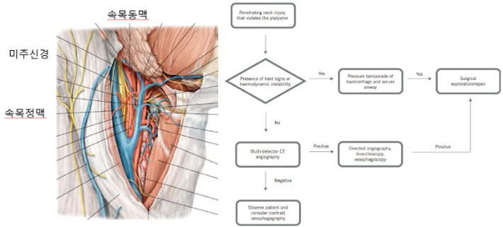 속목동맥과 손목정맥 관련 자료. 오른쪽은 치료 알고리즘. 대한외상중환자외과학회 제공