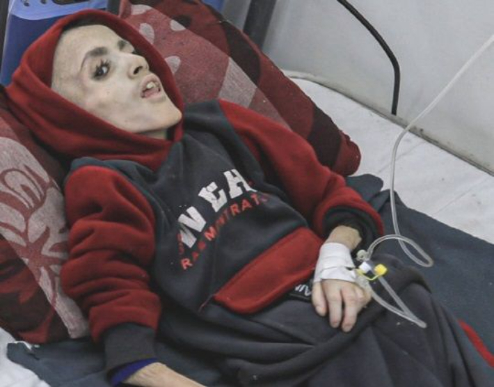 영양실조로 사망한 가자지구 10살 소년 야잔 카파르네. SNS 캡처 