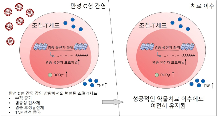 만성 C형 간염 환자의 치료 후에도 남은 염증성 흔적. 기초과학연구원 제공