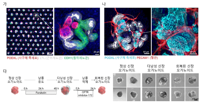 연구팀이 생산한 신장 오가노이드. 김동성 교수 제공