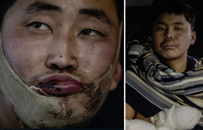 생포된 북한 병사. 연합뉴스