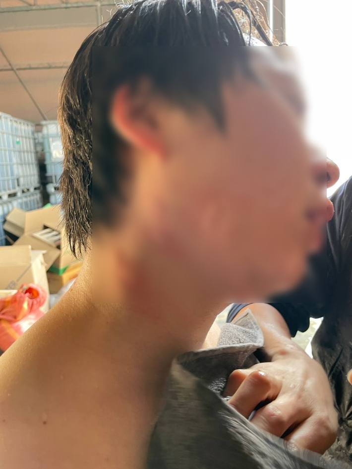 27일 오후 4시 28분쯤 30대 생산팀 직원 B씨가 배관 수리 후 점검을 하던 중 튄 황산에 얼굴과 목, 팔 등에 화상과 호흡 곤란을 겪는 사고가 발생했다. 금속노조 에너지머티리얼즈지회 제공