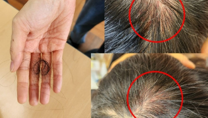 부산서 초등생이 교사 폭행…되레 아동학대로 신고 당해