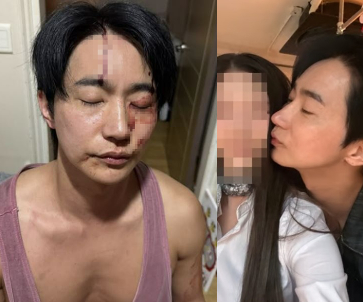 "피 흘리며 경찰 불렀다"…전호준, 전 여친 폭행 주장 정면 반박