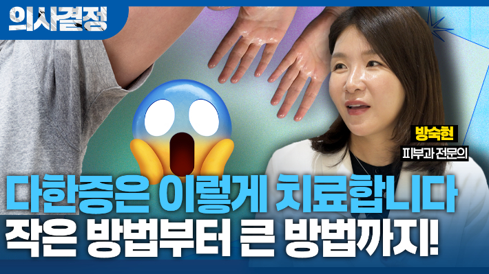 "다한증은 일단 수술? NO!" 안전한 다한증 치료방법[의사결정]