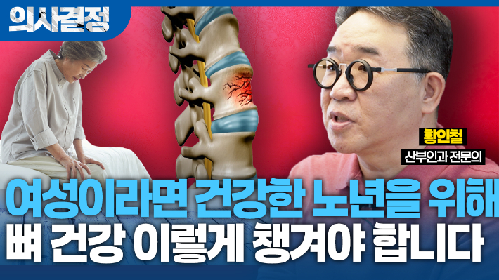 '침묵의 살인자' 골다공증의 역습…여성의 뼈, 50세부터 무너진다[의사결정]