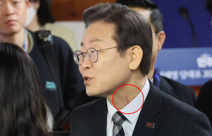 천준호 "尹정권, '이재명 피습' 조직적 축소·은폐"