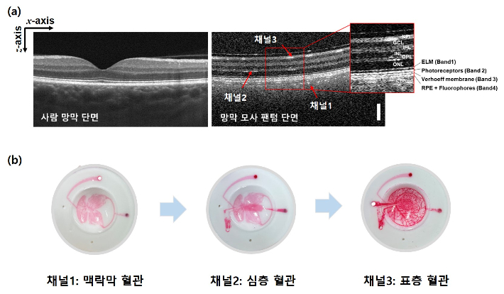 KRISS가 개발한 망막 모사 안구 팬텀의 구조. KRISS 제공