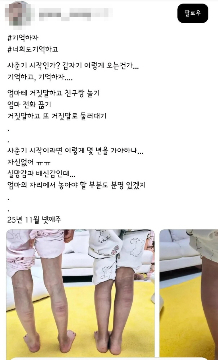 한 엄마가 '훈육일지'라면서 아이 두 명에게 회초리질을 한 사진을 올렸다. 두 아이의 종아리가 피멍으로 짙게 물들었다. 쓰레드 캡처
