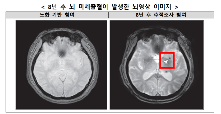 국립보건연구원 제공