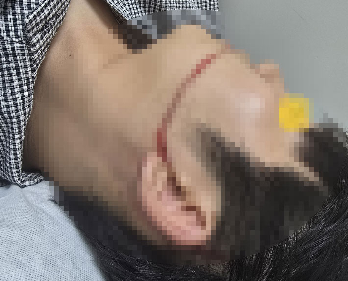 사고 당시 피해자 A씨의 얼굴. 연합뉴스