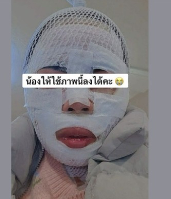 화상 입은 태국인 아내. SNS 캡처