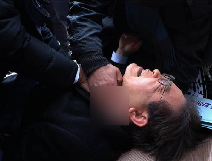 지난 2024년 1월 2일 당시 더불어민주당 이재명 대표가 부산 가덕도 신공항 부지를 둘러본 후 기자들과 문답을 진행하던 중 왼쪽 목 부위에 습격을 당해 피를 흘린 채 쓰러졌다. 연합뉴스