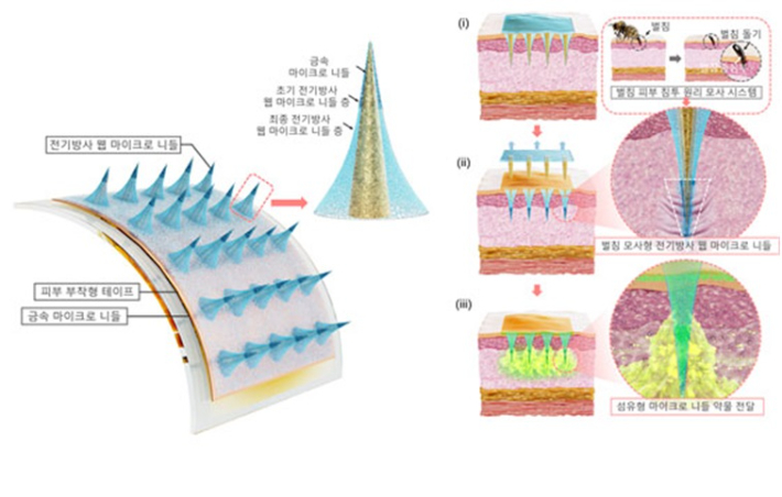 전기방사 웹 마이크로 니들 구성 및 벌침 모사형 피부 삽입 및 서방형 약물 전달 개요도. 기계연 제공