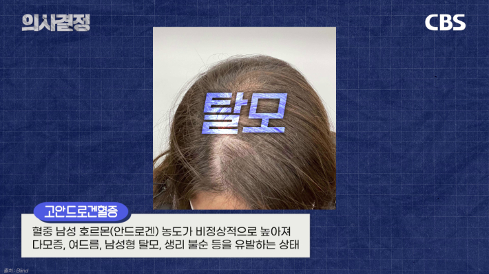 두번째봄 여성의원 정선화 원장 편 '의사결정' 유튜브 캡처