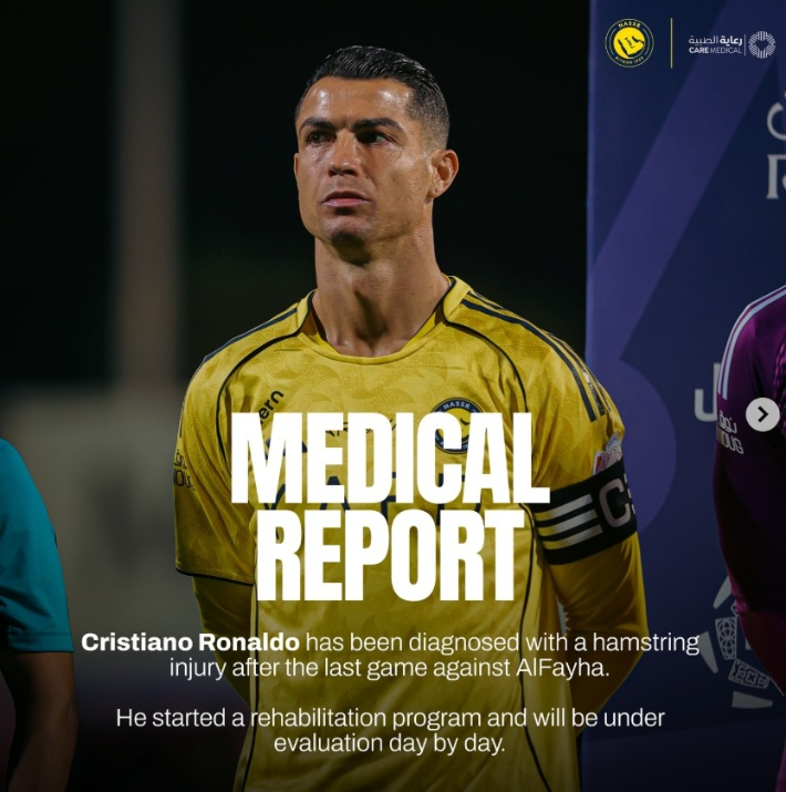 알나스르 SNS 캡처