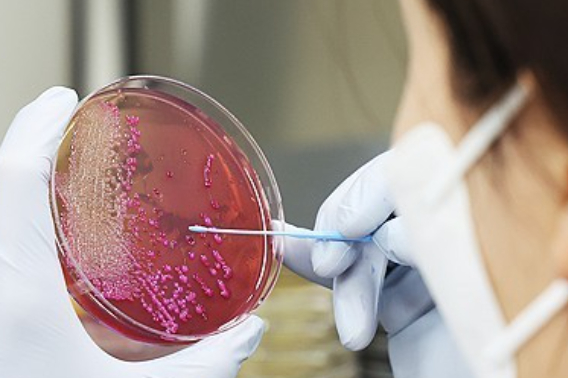 식중독 검사 장면. 연합뉴스