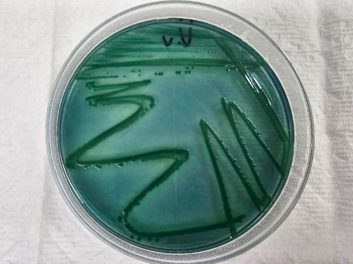 비브리오패혈증균. 전라남도 보건환경연구원 제공