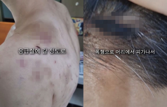 온라인 커뮤니티 캡처