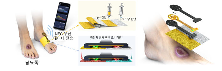 당뇨족 및 당뇨성 질환 진단을 위한 다중모달 비색 드레싱 및 광전자 센서의 개념도. KAIST 제공