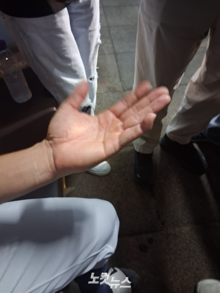 두산 정수빈의 접질린 왼 새끼손가락. 노컷뉴스 