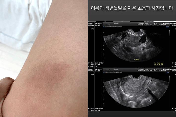 A씨 SNS 캡처